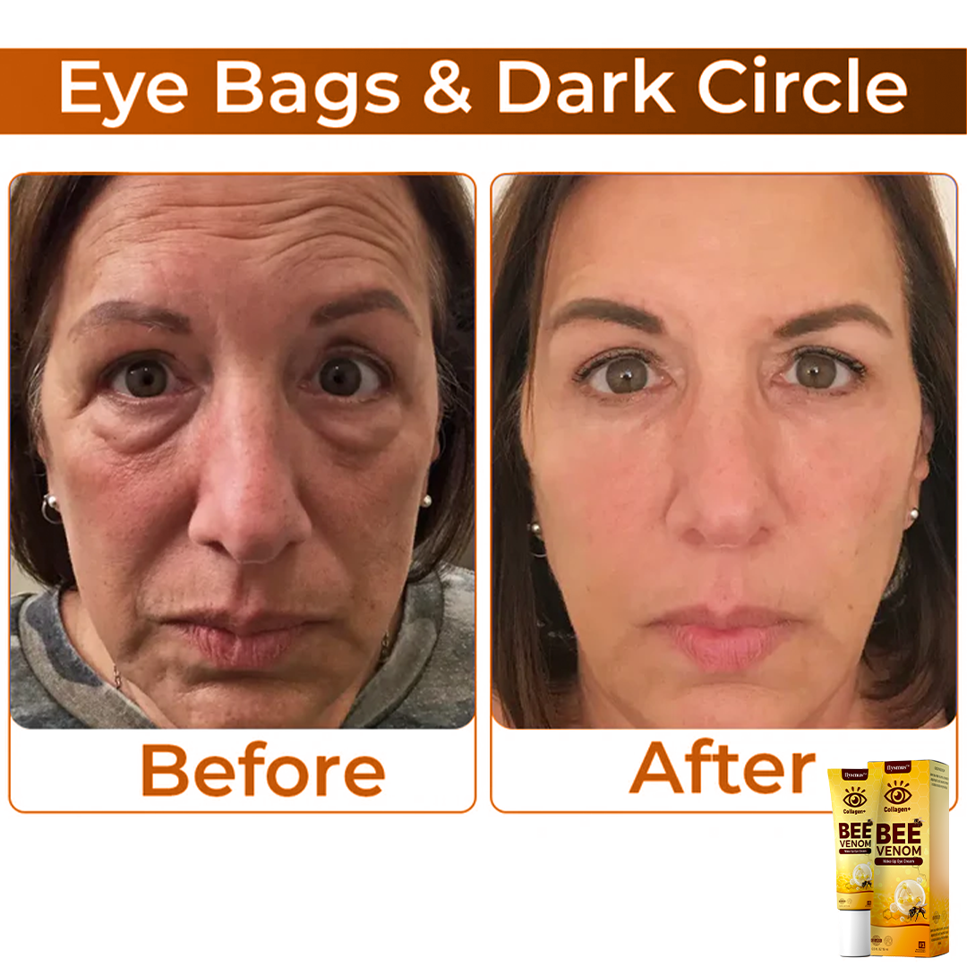 Bee Venom+Collagen: Awaken your gaze