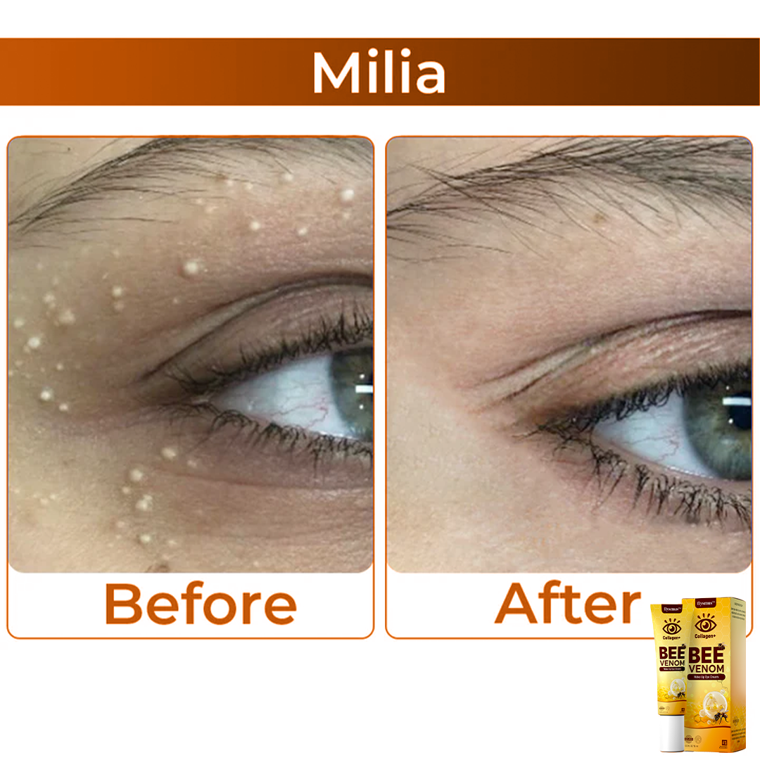 Bee Venom+Collagen: Awaken your gaze
