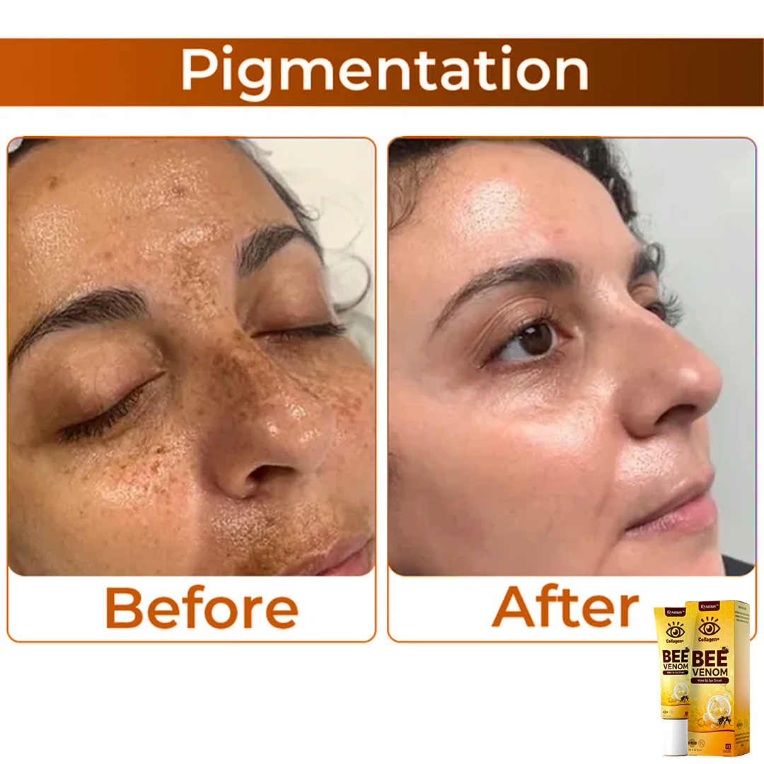 Bee Venom+Collagen: Awaken your gaze