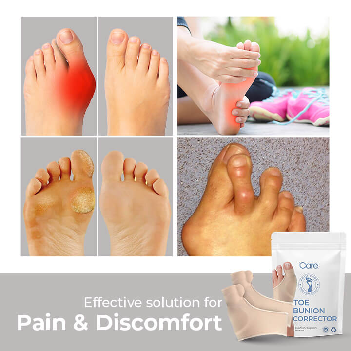 BunionPro™ | Correct Your Toe Bunion In 7 Day