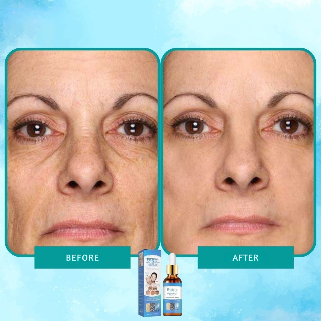 Intense anti-wrinkle Botox serum elixir 