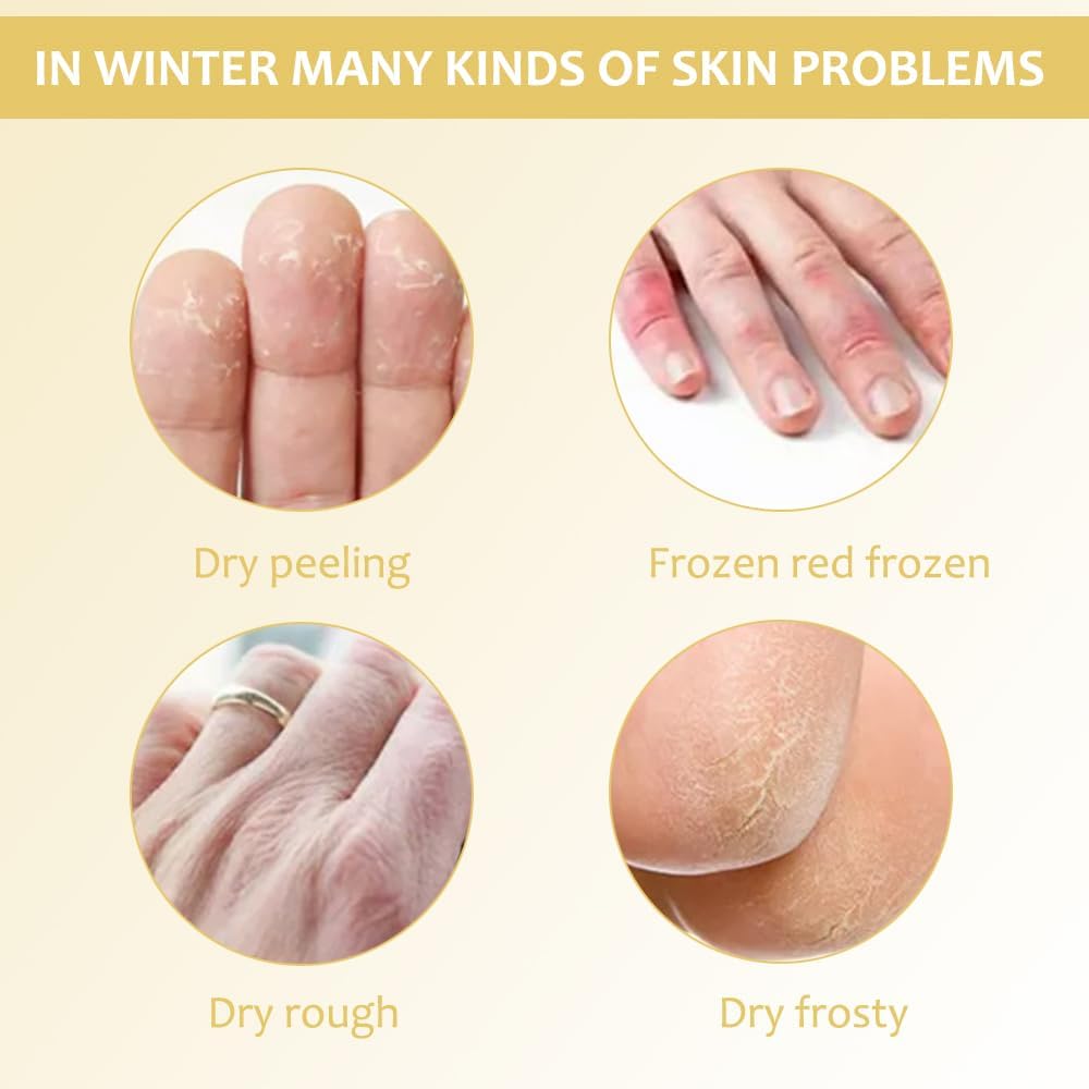 Give your dry skin an intense repairing treatment 